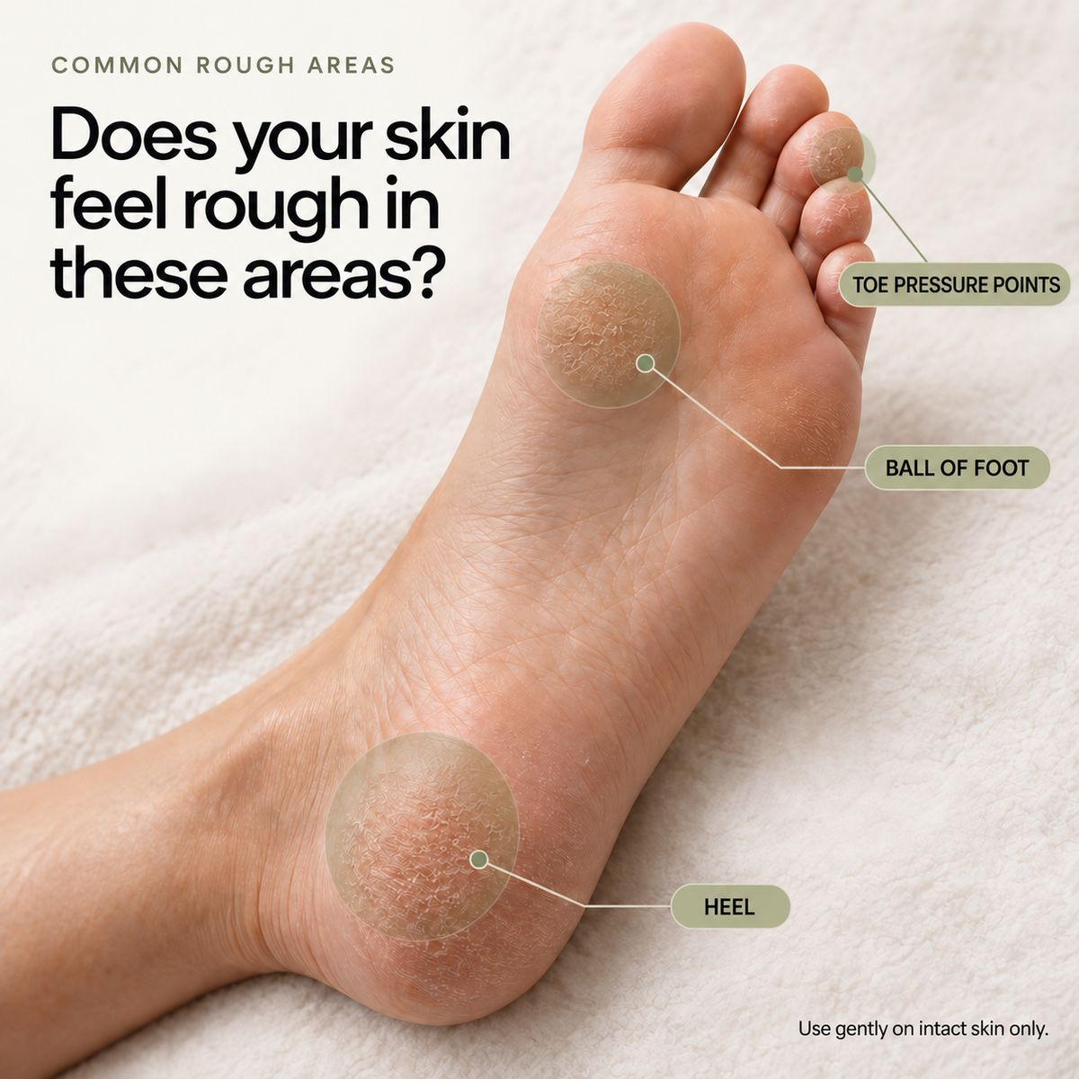 VIREVA — Common areas of rough skin