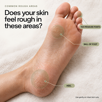 VIREVA — Common areas of rough skin